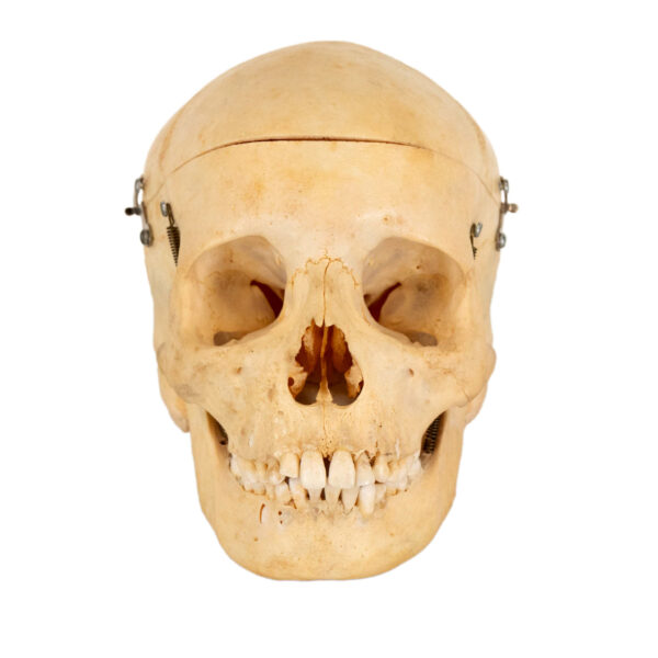 CAROLINA BIOLOGICAL SUPPLY CO. Human Skull Dental Study - Image 1