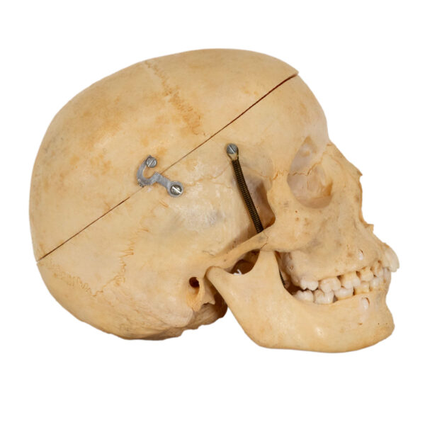 CAROLINA BIOLOGICAL SUPPLY CO. Human Skull Dental Study - Image 4