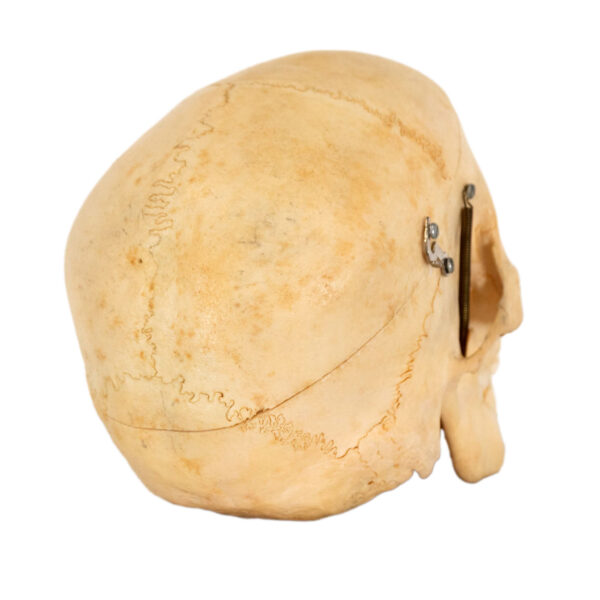 CAROLINA BIOLOGICAL SUPPLY CO. Human Skull Dental Study - Image 5