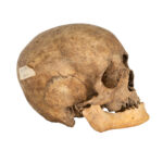 Vintage Human Skull - Image 2
